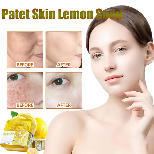 Patet Skin , Patetskin Bright & Even Lemon  Bar, Patet Skin Essential Oil  Bars, Patet Skin  Bar, Patet Skin Care  Lemon Acid  for Hyperpigmentation, Dark Spots (Aloe)